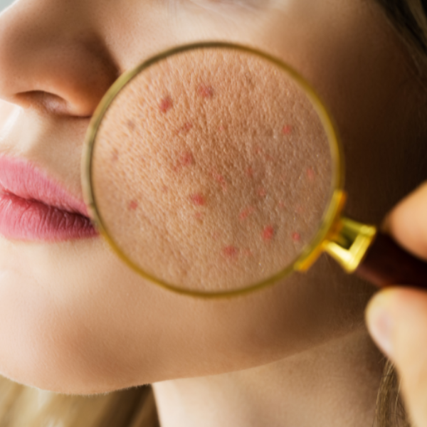 Department Image: Department of Dermatology